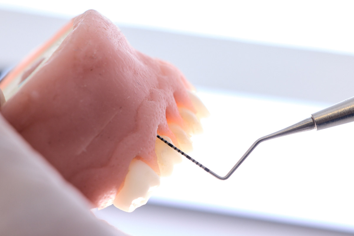 soins des gencives
